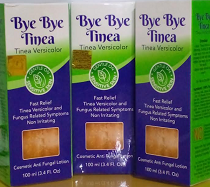 BODY LOTION - BYE BYE TINEA ANTI FUNGAL LOTION 100ML
